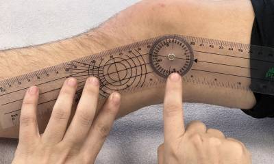 Messinstrument: Goniometer Messung am Kniegelenk